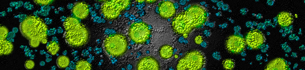 Biofilm Microbes