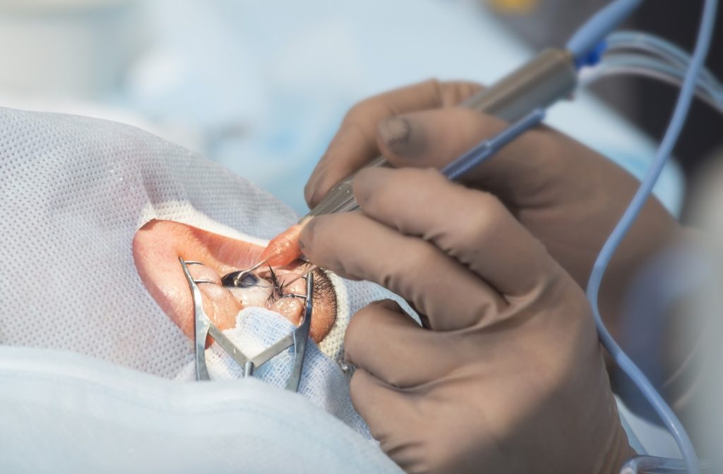 An opthalmologist performs cataract surgery on a patient