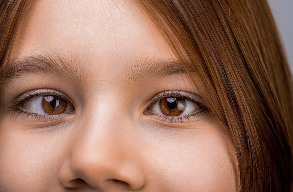 Close up of a child with strabismus.